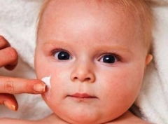 婴儿眼皮上的湿疹怎么治疗,婴儿眼边有湿疹怎么办