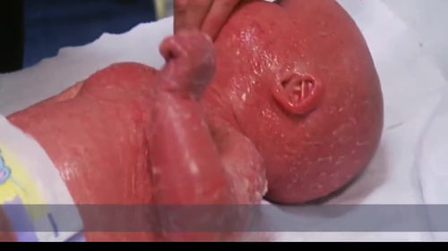 孕妈的肚子是 火炉 吗 宝宝一出生却是这个样子,到底是怎么回事 