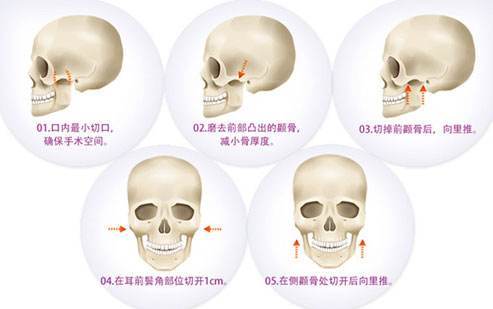 千里挑一的钟楚曦整容前照片被扒,打脸冯小刚零整容之说 