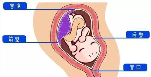 孕产说 胎盘前壁后壁哪个安全 还有哪些是需要注意的呢