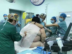 湖南280斤孕妇生产 16名医务人员出动 