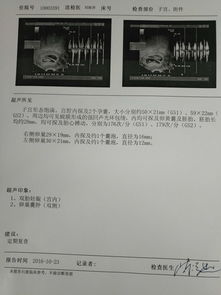 试管毕业论文