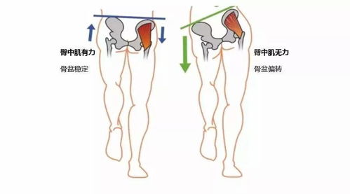 别再用 腿 跑步了 这个部位没力量,跑量越多越受伤