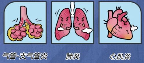 每年8万人因它而死,90 病因或由100多种病毒引起,这才是最被人类低估的疾病