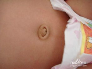 新生儿肚脐护理 新生儿肚脐怎么护理