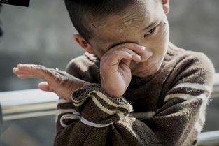 云南9岁男童患怪病疯狂击打头部,家人无奈用绳捆住双手防自残