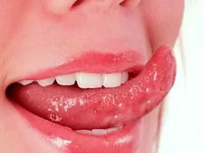 舌头中间裂开是什么原因