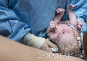 她请摄影师拍摄分娩时宝宝未剪掉脐带的样子,你见过这样的照片吗