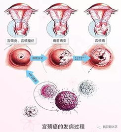 推荐 女人有无妇科病,几秒就可以看出