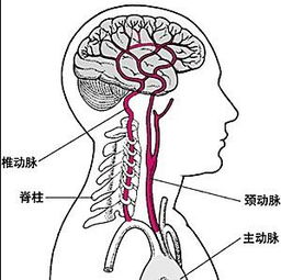 脑供血不足怎么办