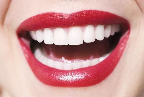 牙齿美白几种方式的对比