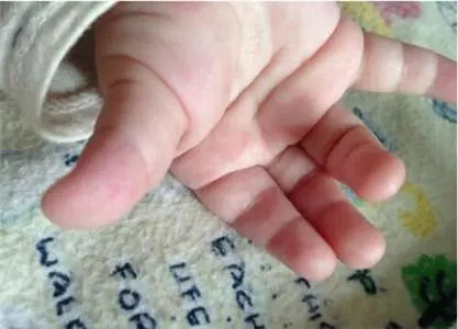 为啥宝宝手脚总是 湿哒哒 的 五个原因只有最后一种需要特别警惕