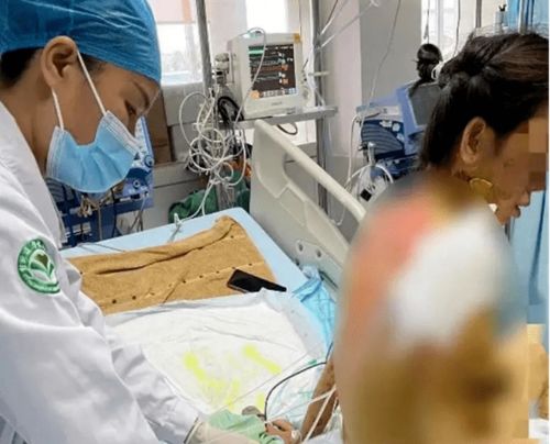 桂林一女子出现发烧等症状,自行吃消炎药,导致住进了ICU