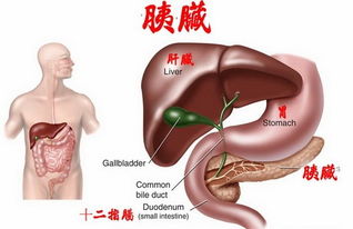 胰脏癌的并发症 