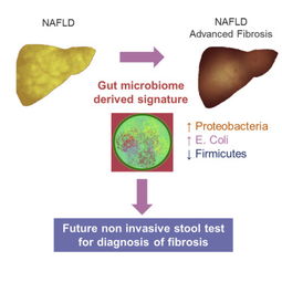 粪便微生物有望检测早期脂肪肝和肝硬化 