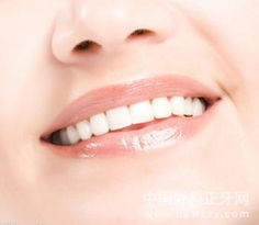 牙齿整形手术？常见的牙齿整形方法 牙齿整形的注意事项