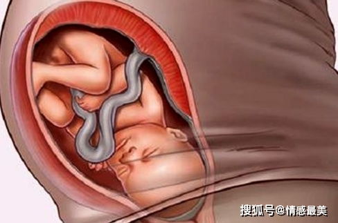 胎儿入盆是什么感觉？孕妇会有什么感觉呢