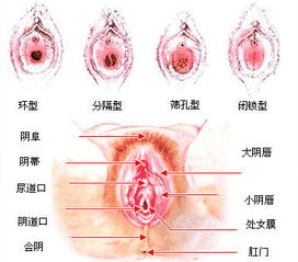 科普图解 处女膜在阴道什么位置
