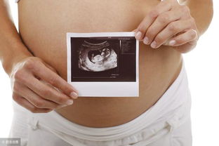 子宫后位会影响怀孕吗