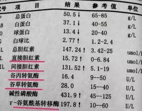 转氨酶高是什么原因造成的 这8个因素或是关键,麻烦早些了解