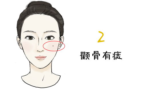 女人腮骨有痣图片