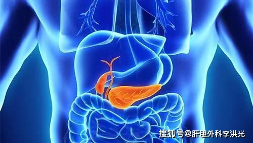 体检检查胆囊息肉怎么办 胆囊息肉一定要切除胆囊吗 健康百科