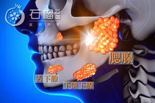 流行性腮腺炎竟是引起男性无精不育的导火索