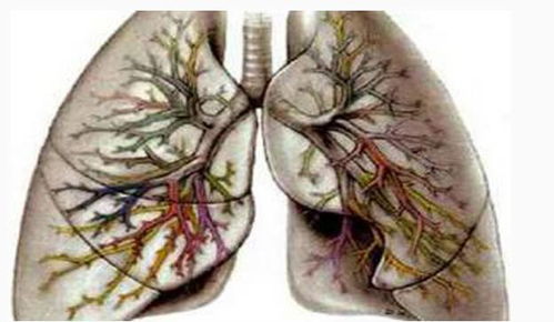 有这几个症状的人,肺部可能有病变,尤其是吸烟者,最好去查查 