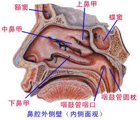 得了鼻炎怎么办，得鼻炎怎么办