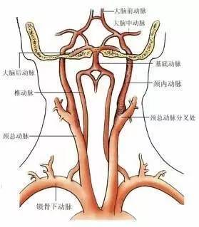 颈动脉超声检查到底查了点啥 