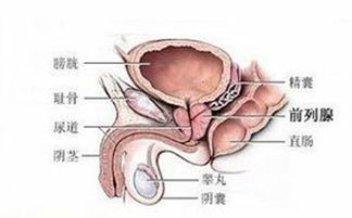 前列腺增生的检查诊断方法