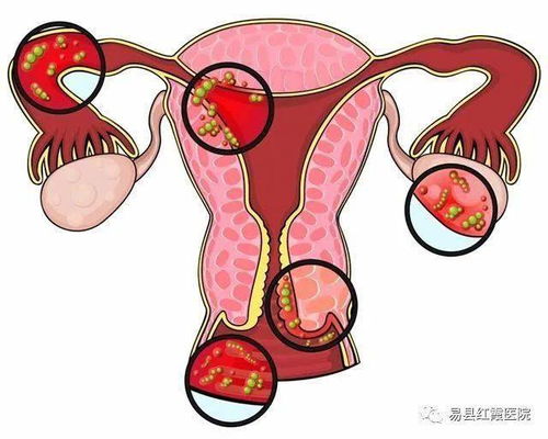 女性有这4个表现,可能被妇科疾病盯上了,请尽早治疗