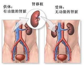 揭秘卖肾车间被查背后肾脏给了谁,保养肾脏最好的方法有什么