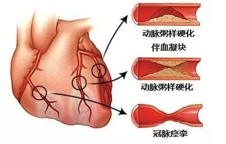 心脏病能治好吗为何(心脏病能治好吗为何不能治愈)