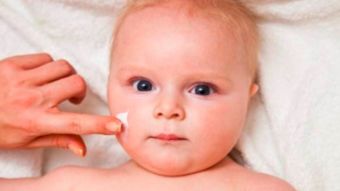 婴儿湿疹护理常识,第五个当牢记