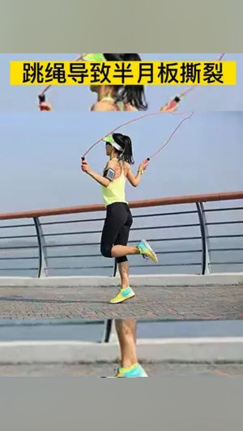 运动需适度,健康最重要 93斤女子每天跳绳4千下致半月板撕裂 跳绳减肥可取吗 