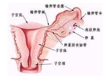 生殖道解剖结构异常能引起流产