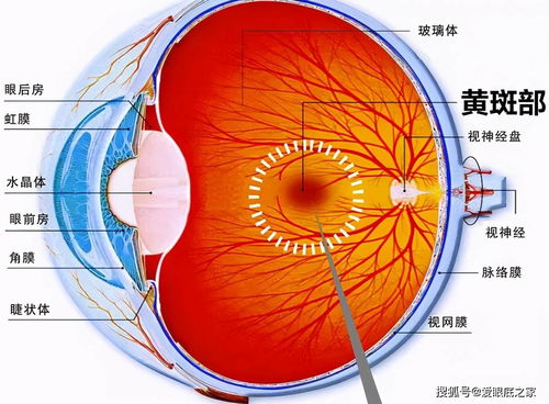 爱眼底 眼睛发生黄斑病变,离不开这5个原因 早预防 早治疗