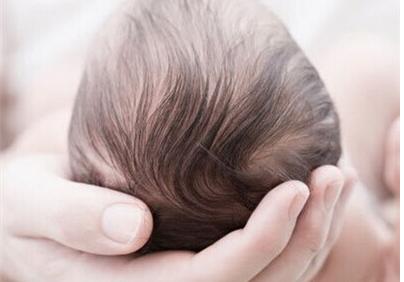 宝宝头发稀少怎么办 宝宝头发稀疏怎么办