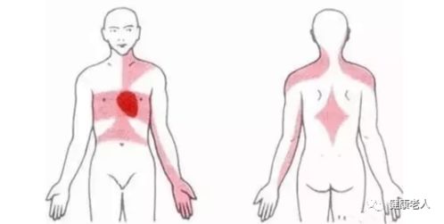注意 这个地方疼千万别当骨科病,严重时心跳随时可能停 请互相提醒
