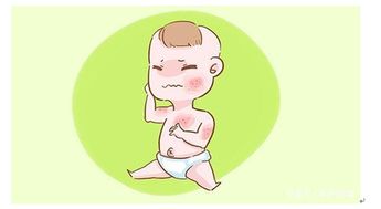 儿童湿疹症状(儿童得了湿疹具体的症状有哪些)