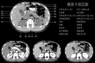 443例实例教你解读腹部CT