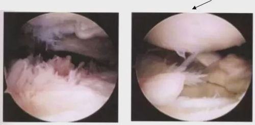 老年人腿膝盖关节痛是怎么办 老人关节炎腿疼怎么治疗 健康百科