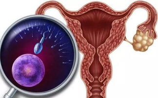 甲状腺功能对多囊卵巢综合征患者和非多囊卵巢综合征患者妊娠和新生儿结局的影响