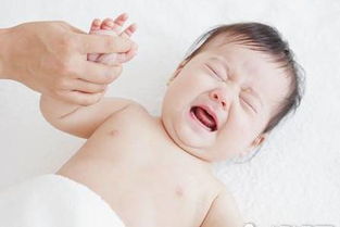 10招检测宝宝是否为过敏体质