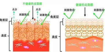 为什么那么多激素脸