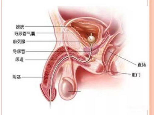 新冠的后遗症是什么症状生殖感染的（感染新冠有后遗症） 第1张