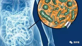 肠道菌群的专家建议是什么，怎么增加肠道菌群(如何让肠道菌群平衡提高免疫力)