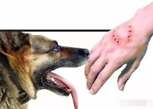 狗咬伤,如何判断是否需要打狂犬疫苗 