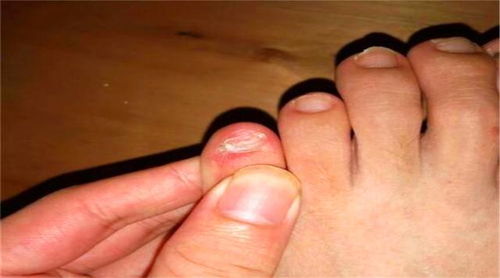 小脚趾的指甲分成两半的人,他们究竟什么来历 说出来你别不信